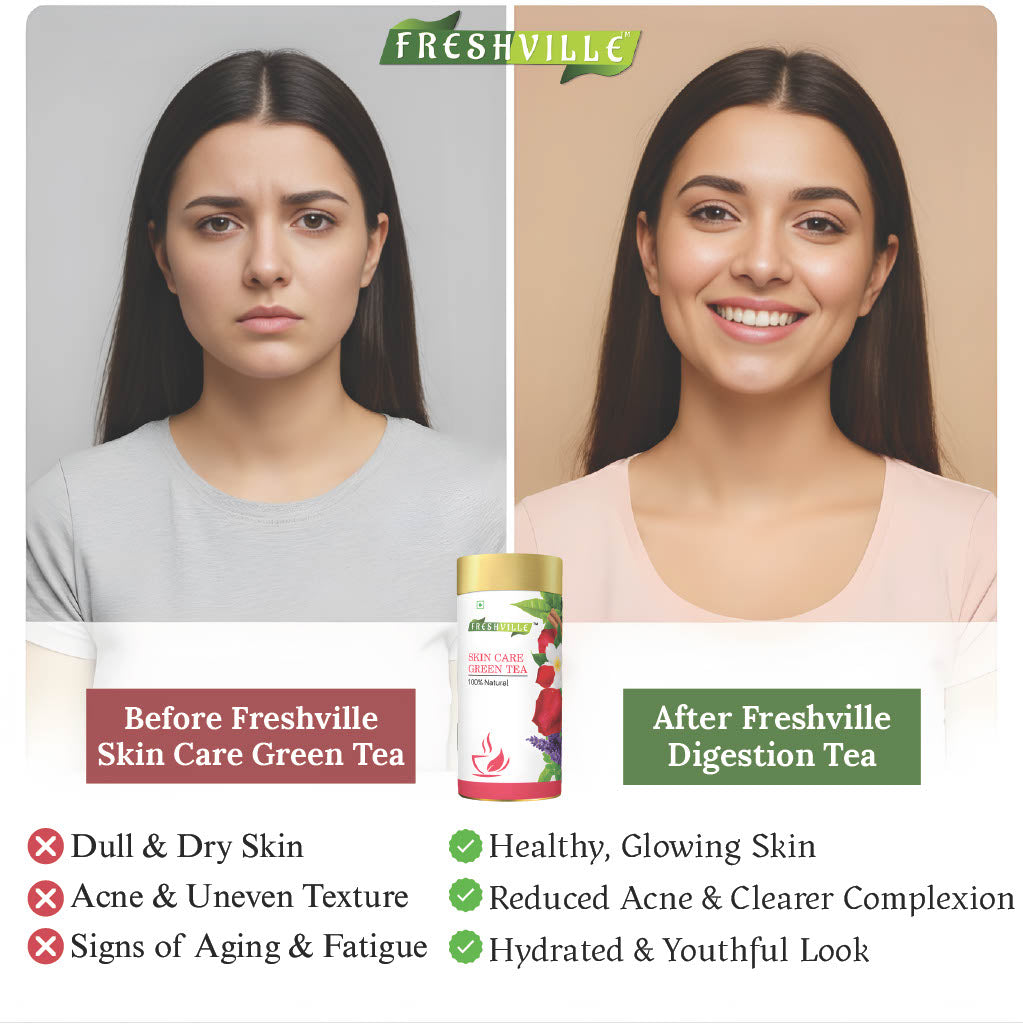 Freshville Skin Care Green Tea | Glowing Skin, Moisturized Skin, Anti-Aging | With Herbs Moisturized Skin, Acne, Anti-Aging