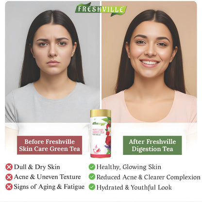Freshville Skin Care Green Tea | Glowing Skin, Moisturized Skin, Anti-Aging | With Herbs Moisturized Skin, Acne, Anti-Aging