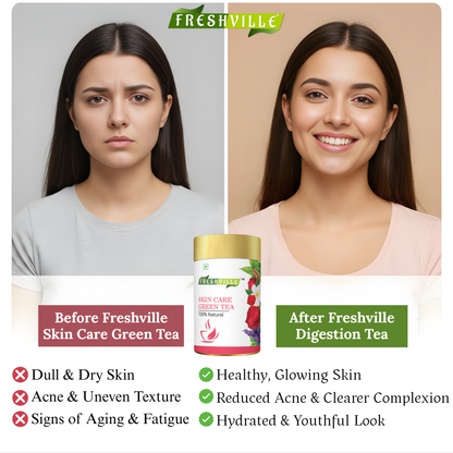 Freshville Skin Care Green Tea | Glowing Skin, Moisturized Skin, Anti-Aging | With Herbs Moisturized Skin, Acne, Anti-Aging, 45 Day