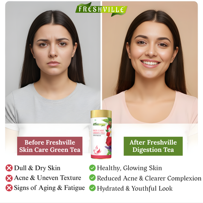 Freshville Skin Care Green Tea | Glowing Skin, Moisturized Skin, Anti-Aging | With Herbs Moisturized Skin, Acne, Anti-Aging, 100GM